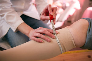 photo showing an anti-embolism stocking being measured on a leg | Dr. Amish Tilara