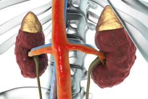 Adrenal Gland Vein Sampling - Atlanta Vascular & Vein Center